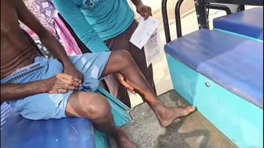 মন্তেশ্বর: মন্তেশ্বরে ব্যাঙ্ক থেকে টাকা তুলে ফেরার পথে মোটরসাইকেলের ধাক্কায় গুরুতর আহত এক ব্যক্তি