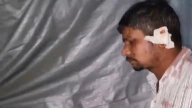 रतनी फरीदपुर: शकूराबाद: पिता से पैसे लेने पर बड़े भाई ने छोटे भाई से की मारपीट, छोटा भाई घायल