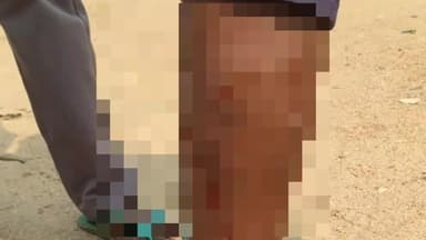 হুড়া: স্কুল যাওয়ার সময় স্কুল গেটের অদূরে কুকুরের কামড়ে আহত হুড়া হাই স্কুলের নবম শ্রেণীর ছাত্র,আতঙ্কে অন্যান্য ছাত্রছাত্রীরা