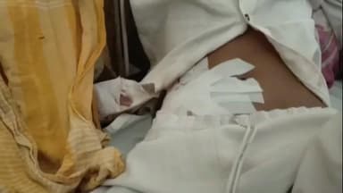 কাটোয়া ১: দাঁইহাটের রাসের শোভাযাত্রার মধ্যে থেকেই যুবকের পেটে ব্লেড চালিয়ে দেওয়ার অভিযোগ, জখম যুবক চিকিৎসাধীন কাটোয়া হসপিটালে