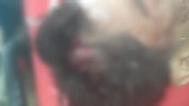 करनैलगंज: दत्त नगर के पास ट्राली से टकराई बाइक, अयान की मौत, दो लोग गंभीर घायल