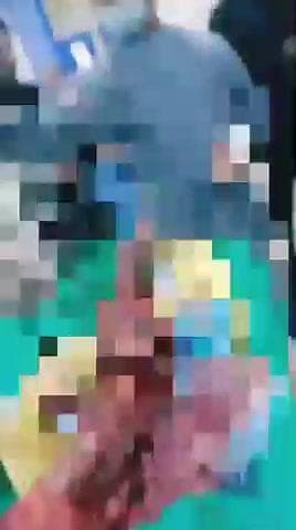 నారాయణ్ఖేడ్: సంజీవనరావుపేట శివారులో విషాదం, వరి కోత కోస్తున్న యువకుడి కాలు హార్వెస్టర్ మిషన్ లో పడి నుజ్జు నుజ్జు