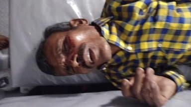 నారాయణ్ఖేడ్: రాజారాం తండా శివారులో రోడ్డు ప్రమాదం, ఇద్దరికి తీవ్ర గాయాలు , ఆస్పత్రికి తరలింపు