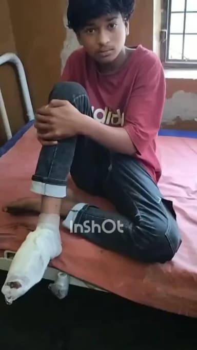 सफीपुर: सफीपुर के आसीवन में दो बाइकों की आमने-सामने भिड़ंत, किशोर सहित 2 लोग गंभीर घायल, मियागंज सीएचसी में भर्ती