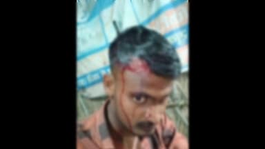 भगवानपुर हाट: भगवानपुरहाट थाना क्षेत्र के बिलासपुर गांव में युवक के साथ मारपीट, थाने में शिकायत दर्ज