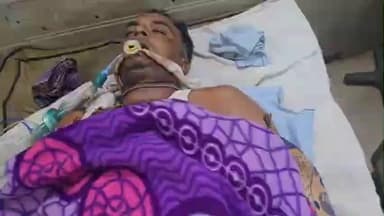 पीपलदा: अयाना थाना क्षेत्र में मोटरसाइकिल दुर्घटना में एक शख्स गंभीर रूप से घायल, एमबीएस अस्पताल में भर्ती, उपचार जारी