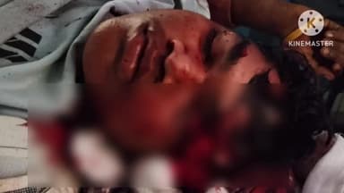 మహబూబాబాద్: కొత్తగూడ మండలం బూరుగు గుంపులో రోడ్డు ప్రమాదం, బైకును ఢీకొన్న ట్రాక్టర్ , మడగూడకు చెందిన వ్యక్తికి తీవ్ర గాయాలు