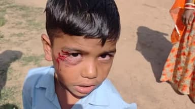 हिण्डोली: हिंडोली उपखंड के सरकारी विद्यालय में बंदरों के आतंक से आधा दर्जन से ज्यादा विद्यार्थी हुए घायल, अभिभावकों में भय व्याप्त