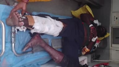 తాడ్వాయి: తాడ్వాయి వద్ద ఇసుక లారీ ఢీకొని ఇద్దరికి తీవ్ర గాయాలు