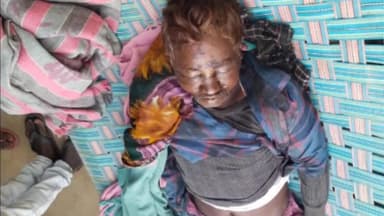 रंका: नशे में भतीजे ने चाचा को पीटा, इलाज के दौरान रास्ते में हुई मौत