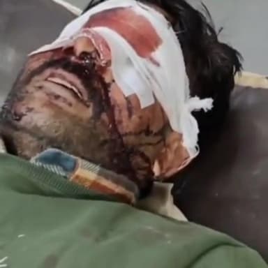 कठूमर: ईशरोती गांव में बदमाशों ने एक युवक पर कुल्हाड़ी से वार कर गंभीर रूप से घायल किया, ₹47000 व मोबाइल लूट लिया