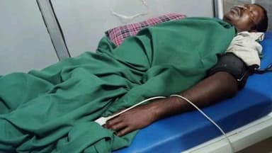 जरमुण्डी: भगवानपुर निवासी शशिकांत यादव सड़क दुर्घटना में घायल, इलाज के दौरान मौत