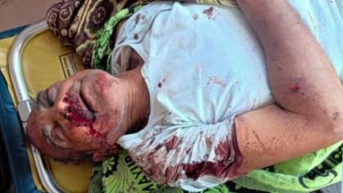 మెట్పల్లి: మెట్ పల్లి పట్టణంలో తండ్రి పై కొడుకు కత్తి తో దాడి...తండ్రికి తీవ్ర గాయాలు..
ఆసుపత్రికి తరలింపు.