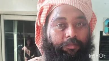 चांदपुर: नूरपुर रास्ते के विवाद में दो पक्षों के बीच हुई मारपीट, खूनी संघर्ष में चले लाठी-डंडे, पांच घायल