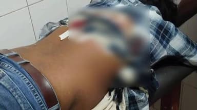 गोला: आपसी विवाद में युवक पर चलाई गई गोली, गगहा थाना के नरौहा में घायल की स्थिति गंभीर, जिला अस्पताल रेफर