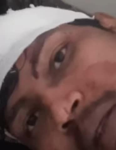 चुरहट: धुम्मा में चार लोगों के साथ मारपीट, स्वास्थ्य केंद्र में इलाज जारी