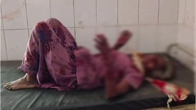 सिकंदरा: राजपुर में आवारा कुत्ते के हमले से वृद्ध महिला गंभीर रूप से घायल, प्राथमिक उपचार के बाद जिला अस्पताल रेफर