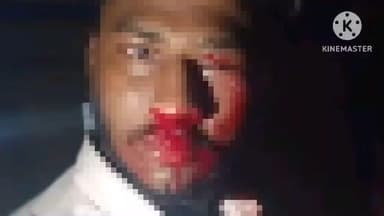 বিষ্ণুপুর ১: ভাসা এলাকায় একটি বাইক নিয়ন্ত্রণ হারিয়ে রাস্তার পাশে দাঁড়িয়ে থাকা একটি পণ্যবাহী লরিতে সজরে ধাক্কা মেরে আহত হয় চালক