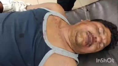 भवनाथपुर: सिमडेगा: बस की टक्कर से युवक गंभीर रूप से घायल, इलाज के लिए भेजा गया