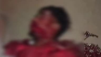 పలాస: సున్నాడా గ్రామ జంక్షన్ సమీప రహదారిపై సైకిల్పై వెళ్తున్న వ్యక్తిని ఢీ కొట్టిన ద్విచక్ర వాహనం,వ్యక్తికి తీవ్ర గాయాలు