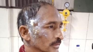 पाटी: चम्पावत के देवीधुरा में पूड़ी तलने के दौरान कढ़ाही में गिरे 7 लोग झुलसे, 4 को हायर सेंटर रेफर किया गया