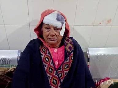 बागेश्वर: पेट्रोल पंप निवासी गीता देवी पर बंदरों ने किया हमला, बचने के लिए भागते समय सीढ़ियों में गिरकर चोटिल हुईं