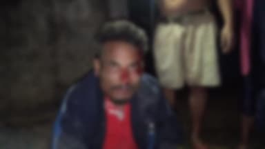 ছয়গাঁও: ছয়গাঁৱৰ মাকেলীত সংঘটিত হৈছে ভয়ানক পথ দুৰ্ঘটনা গুৰুটৰ ভাবে আহট এজন যুৱক