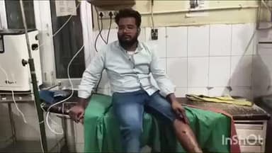 कोल: जयगंज में युवक के साथ मारपीट कर दबंगों ने मारी गोली, घायल ने लूटपाट का विरोध करने पर गोली मारने की कही बात