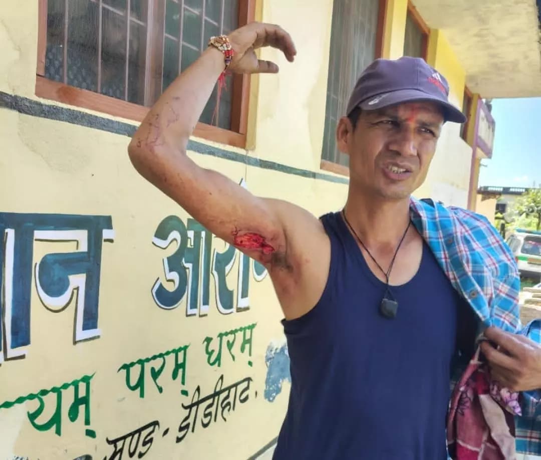 थल: पिथौरागढ़ में जंगली सूअर का हमला, व्यक्ति गंभीर घायल