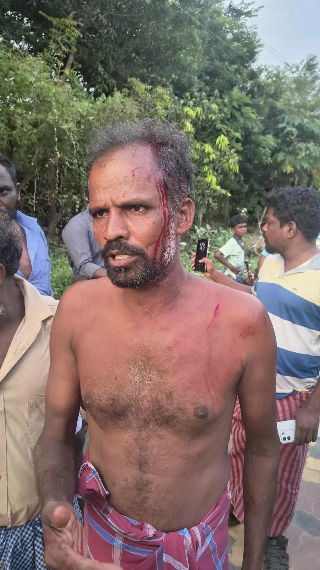 நாங்குநேரி: திருவரங்கனேரியில் முன்விரோதம்: மூவருக்கு கத்திக்குத்து, ஒருவர் கைது