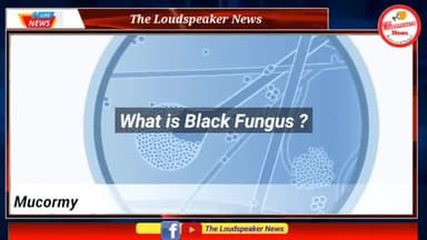 Black fungus से कैसे बचें? | इसके लक्षण क्या है? | सरकार ने महामारी घोषित की
#blackfungus #blackfungas #covid_19 #fungus