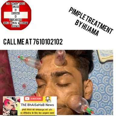 Pimple treatment by hijama
Therapy available in jabalpur
India #hijama