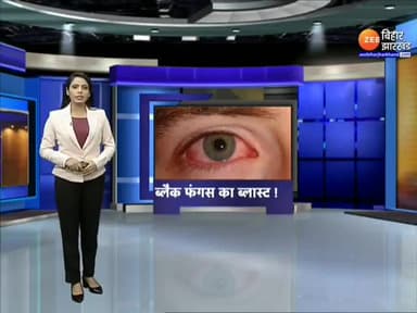 बिहार में ब्लैक फंगस का कहर, 5 मरीजों की मौत। #bihar #blackfungus #black_fungus