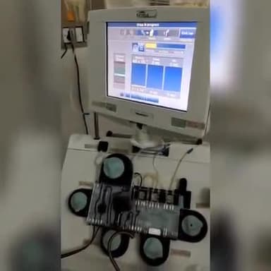 पार्षद अजय कुशवाह ने निभाया मानव धर्म कैंसर की बीमारी से झुझ रहे मोहम्मद के लिए किया SDP रक्तदान
#TEAM_RDS