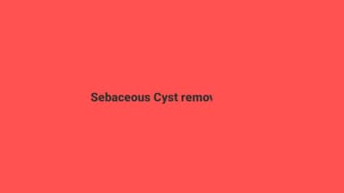 Sebaceous Cyst removed
अंसारी क्लीनिक ,मुंशीगंज रोड , अमेठी
#ansariclinic #skin_doctor #skin_diseases
