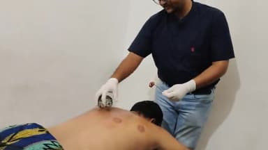 अनावश्यक कमेंट ना करे यह पद्वति प्रमाणित है fire cupping therapy #कमर_दर्द_घुटने_दर्द
अधिक जानकारी के लिए Wp 9928631193