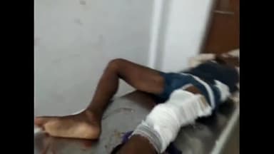 देेेवरिया: #रूद्रपुर मोड़ पर दो पहिया बाहन के स्लिप होने से एक युवक गंभीर रूप से घायल देवरिया आईसीयू से गोरखपुर मेडिकल कॉलेज रिफर