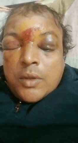 बिहार के बाँका में इंटर के परिक्षार्थियों ने डिस्ट्रिक्ट मज़िस्ट्रेट का ये हाल कर दिया, परीक्षाकाल में चीटिंग रोकने हेतु की थी कोशिश…।
#बिहार #Bihar #बाँका