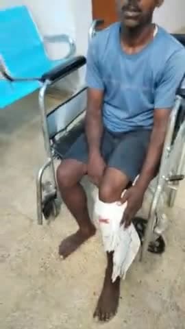 सलखुआ: सिमरी बख्तियारपुर केनरा बैंक के सामने एक ठेला चालक को बाइक सवार किशोर धक्का मारा हुआ फरार😭#shorts #simribakhtiyarpur