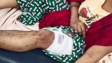 बालसमंद: मुलतानी चौक के पास #मामी पर हमला करने वाले #भांजे नवीन पर मामला दर्ज,बर्फ तोड़ने वाले #सूए से किए थे वार