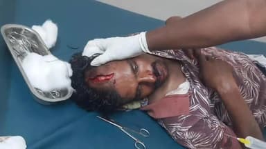 తోట్లవల్లూరు: పెంపుడు కుక్కపై రాయి వేశాడన్న కోపంతో తోట్లవల్లూరు మండలం యాకుమూరు గ్రామానికి చెందిన బొల్లెద్దు వెంకటేశ్వరరావుపై దాడి