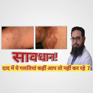 वीडियो के लिए चैनल यूट्यूब पर Pro Skin Solution सर्च करें |
#दाद #चर्मरोग #Fungal Infection
