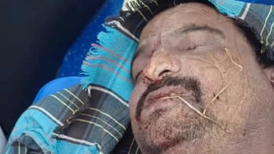 పెనమలూరు: ఈడుపుగల్లు వద్ద అదుపుతప్పి ద్విచక్ర వాహనం బోల్తా, గోపి సాయి అనే వ్యక్తి మృతి