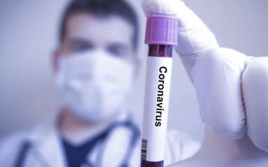 क्या है देश में कोविड-19 के बढ़ते मामलों के पीछे बताया जा रहा XBB.1.16 वैरिएंट? #कोरना_वायरस